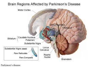 Brain Regions Affected by Parkinson's